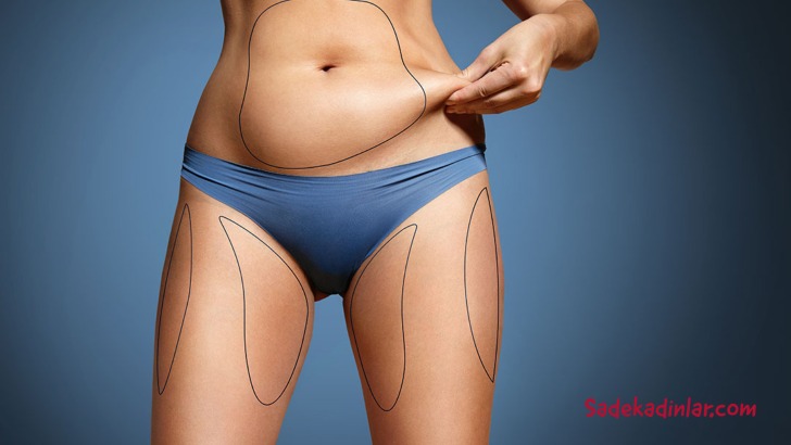 Liposuction Sonrası Kilo Alımı: Yağlar Geri Gelir mi?